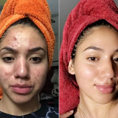 Kojic Acid & Turmeric Soap